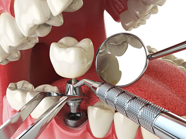 Best Pediatric Emergency Dentist in White Bluff, TN